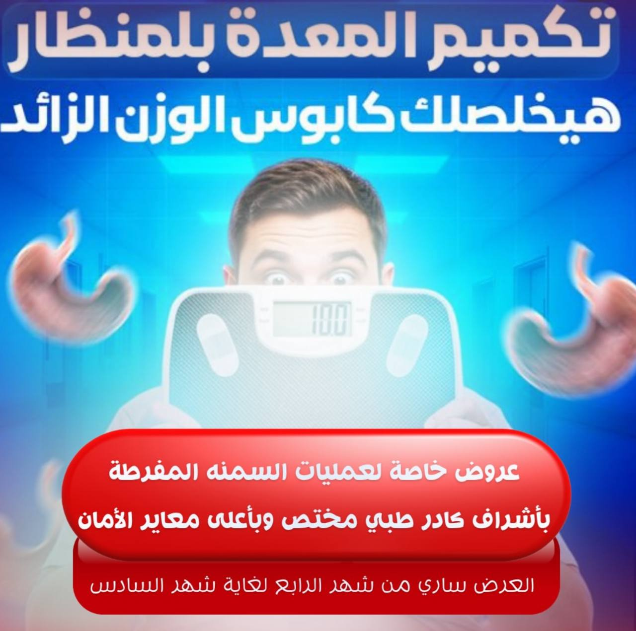 تكميم المعدة